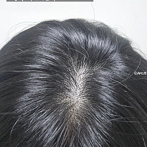 아로마티카 티트리 퓨리파잉 샴푸 지성두피를 위한 피지케어샴푸