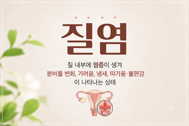 분비물 냄새와 가려움이 있다면? 질염 증상·원인·관리법 총정리