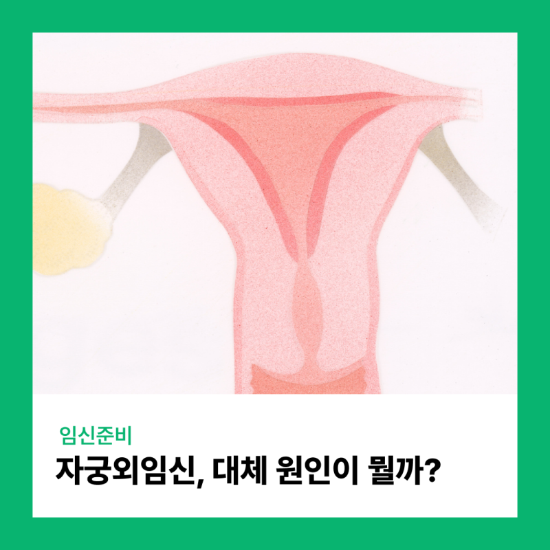 임준생 걱정 유발 '자궁외임신' 원인이 뭘까?