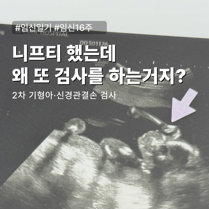 니프티 했는데 2차 기형아 검사 신경관결손 검사 왜 할까?