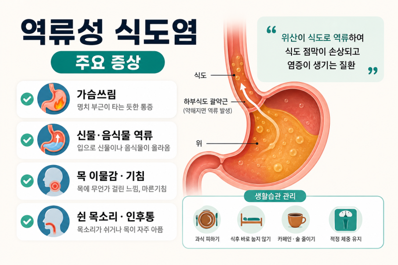 역류성 식도염 그냥 두면 괜찮을까? 병원 가야 하는 증상부터 생활습관까지 총정리