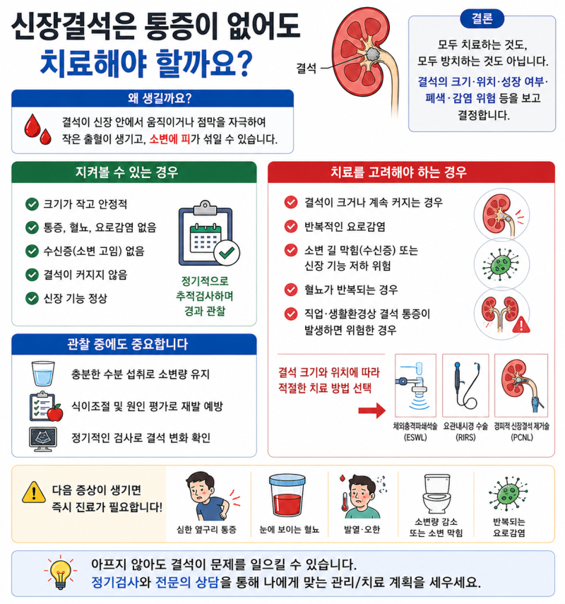 신장결석은 통증이 없어도 치료해야 할까요?