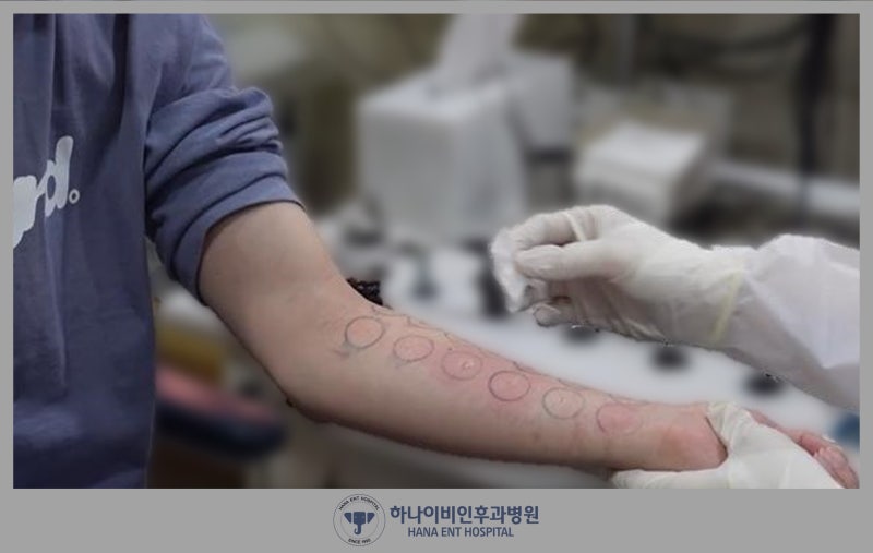 알레르기 비염 검사, 꼭 해야 할까? 검사 종류부터 주의점까지