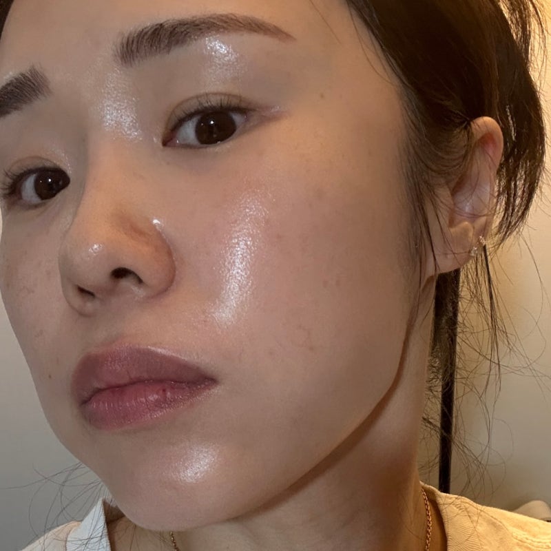 피부과 시술 후 멍,염증 빨리 빼는 법! 초예민 피부 약국 꿀템 (내돈내산)