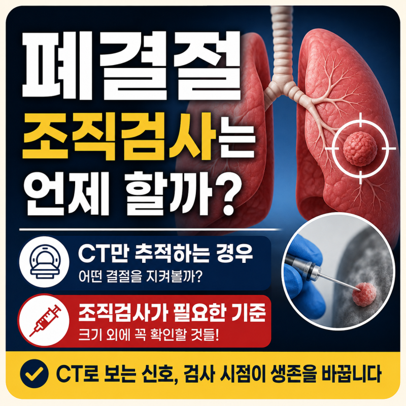 폐결절 조직검사는 언제 할까? CT만 추적하는 경우와 조직검사가 필요한 기준
