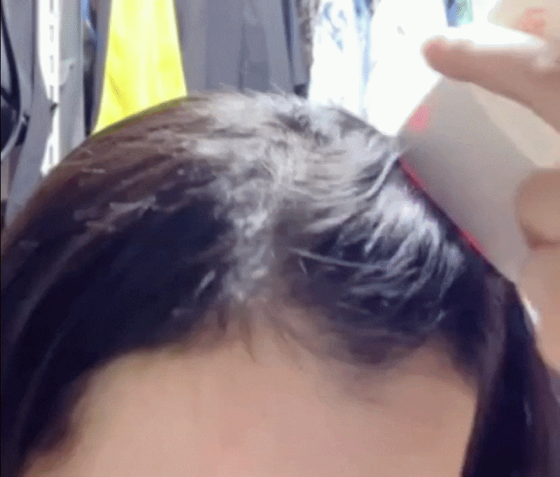 특허 샴푸 써도 한웅큼 빠지는 40대 탈모 고민, 채정안이 픽한 릴리이브 두피 디바이스는 뭐....