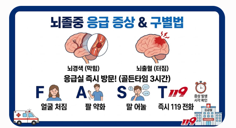 뇌경색 뇌출혈 뇌졸중 차이 응급실 가야 할 증상