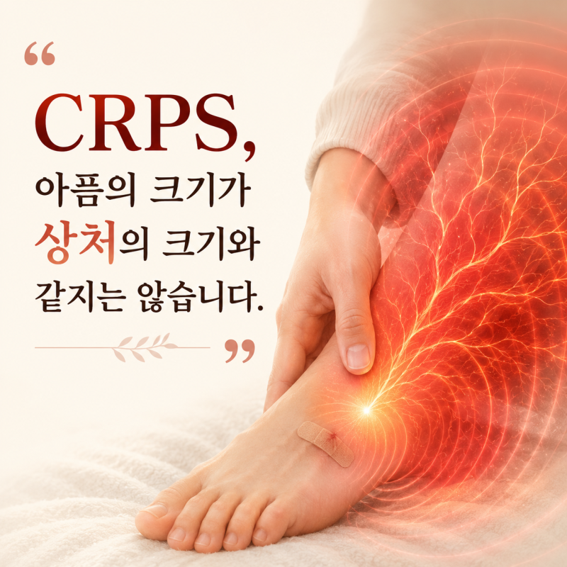 “CRPS, 아픔의 크기가 상처의 크기와 같지는 않습니다.”CRPS 식단, 체력유지 관리 가이드