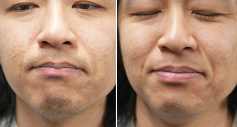 남자 생일 선물 고민하다 선택한 브라운 NEVO, 직접 써보니 달랐던 전기면도기 추천