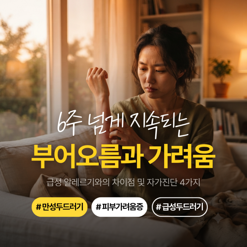 만성 두드러기 증상, 6주 넘게 가렵고 부어오른다면? 급성 두드러기 차이와 자가진단 4가지