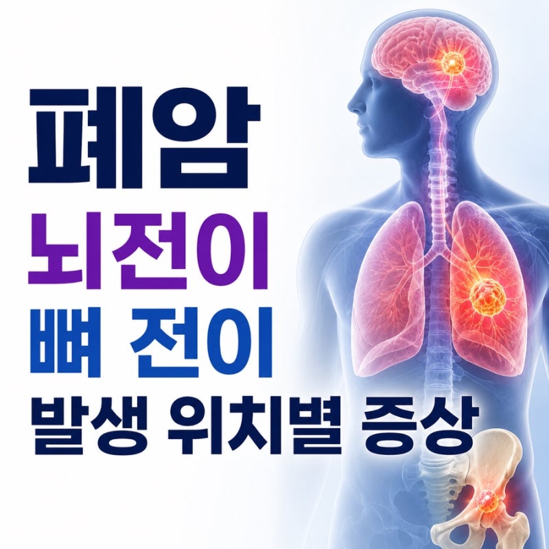 폐암 뇌전이 뼈 전이 발생 위치별 증상 차이는?