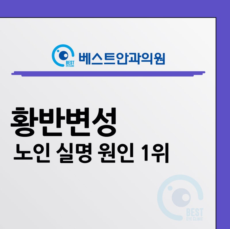 대구 베스트안과, 고령인구 증가, 노인 실명 원인 1위 황반변성