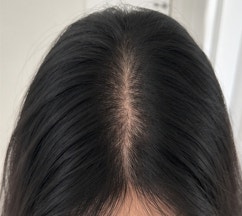 맥주효모샴푸 추천, 탈모 케어에 좋은 탈모샴푸 추천