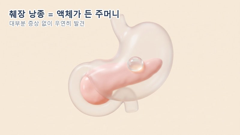복부 초음파에서 췌장에 물혹(낭종)이 보인대요 — 걱정해야 할까요?