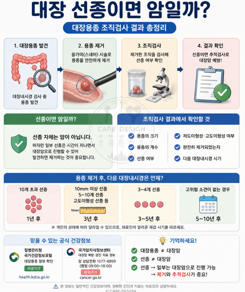 대장 선종이란? 선종이면 암일까｜대장용종 조직검사 결과 총정리