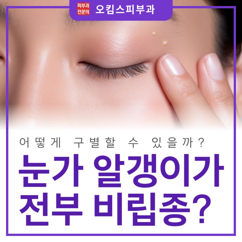 마두동 비립종피부과 눈두덩이 비립종, 한관종·편평사마귀와 구별하는 법