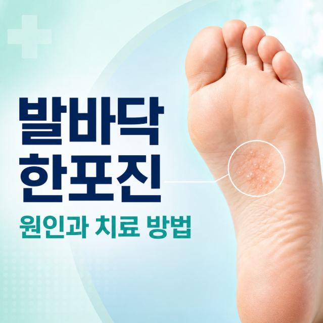 발바닥 한포진 원인은 뭘까? 수포·물집 치료 방법까지