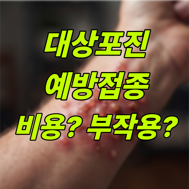 대상포진 예방접종 비용부터 싱그릭스 차이, 부작용 총정리