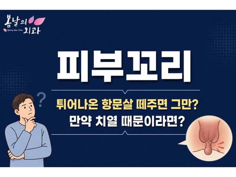 불편한 항문살 돌출, 만약 피부꼬리라면 단순 제거는 재발 위험 높아!
