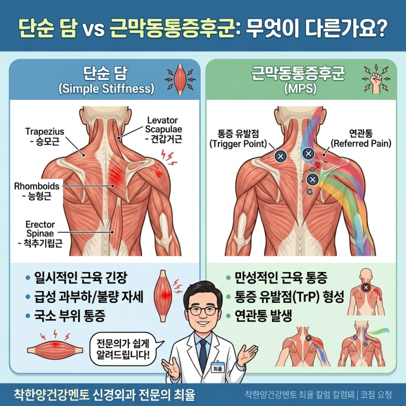 단순 담 vs 근막동통증후군, 어떻게 다른가요? 신경외과 전문의가 알려드립니다
