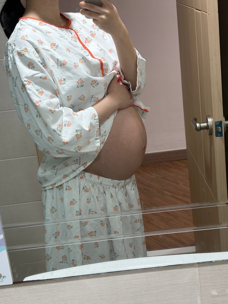 순천 미즈병원 제왕절개 1.2일차