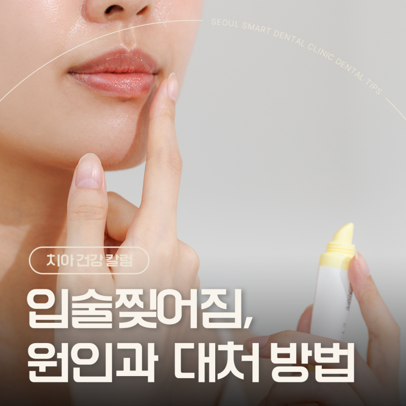 입술 찢어짐 있을 때 원인별 연고 대처 방법