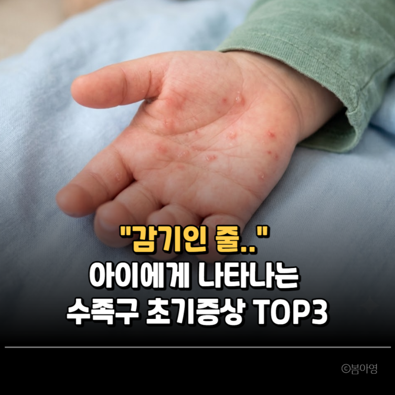 "감기인 줄 알고 약만 먹였더니.." 아이들에게 나타나는 수족구 초기증상 TOP3