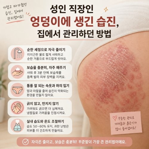 성인 직장인 엉덩이에 생긴 습진, 집에서 관리하던 방법
