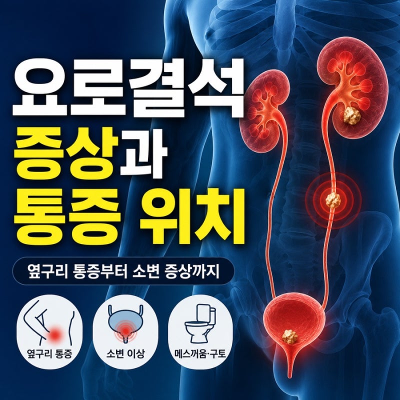 요로결석 초기증상과 통증 위치 -옆구리가 갑자기 아픈 이유