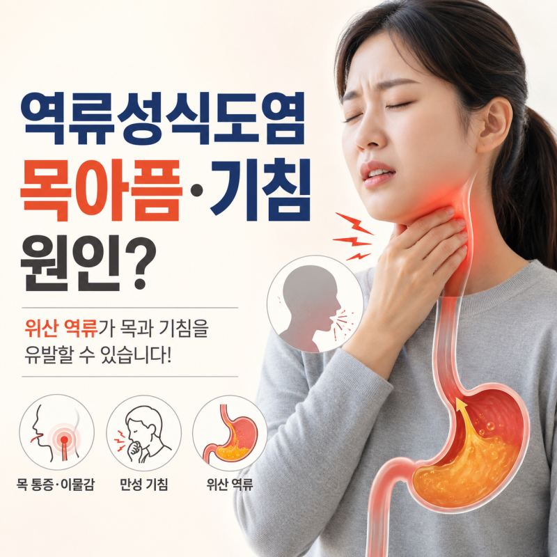 역류성식도염 목아픔·기침, 감기가 아닌데 계속된다면 원인은?