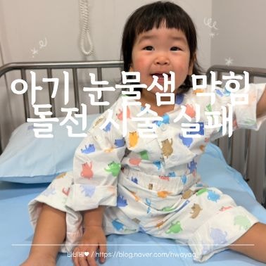 아기 눈물샘 막힘 증상과 돌전 시술 실패 이야기