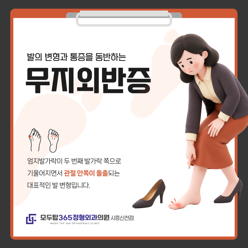 [시흥신천점 정형외과의원] "예쁜 구두 신은 날만 아픈 줄 알았는데… 걸을 때마다 찌릿한 엄....