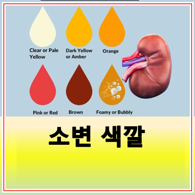소변 색깔로 보는 건강 상태 갈색 붉은색 의미