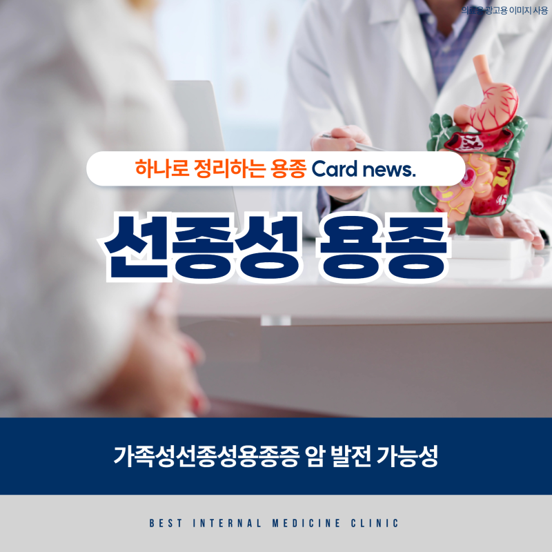 가족성선종성용종증 암 발전 가능성 (vs 비선종성 용종 차이)