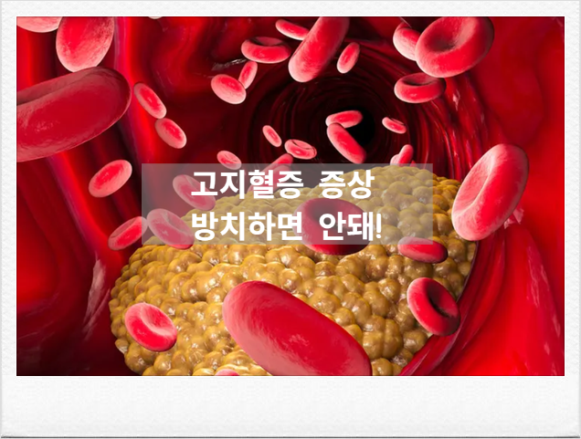 [혈관건강] 침묵의 살인자 고지혈증 증상부터 수치 기준, 약물치료와 맞춤식단