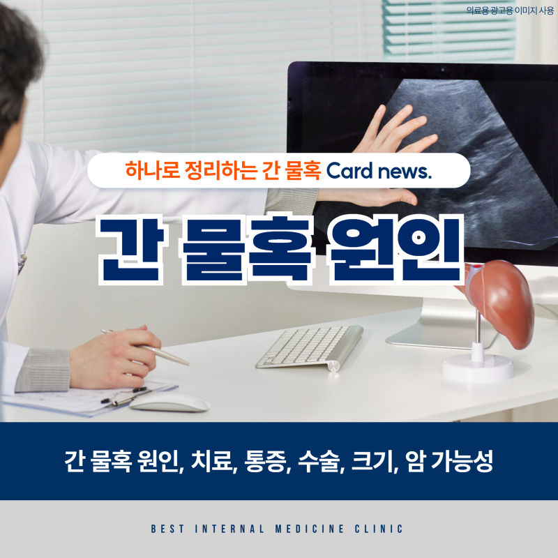 간 물혹 생기는 이유 : 원인, 치료, 통증, 수술, 크기, 암 순서대로 정리