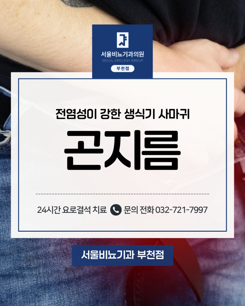 생식기 주변 돌기 만져진다면? 곤지름 원인과 의심 증상