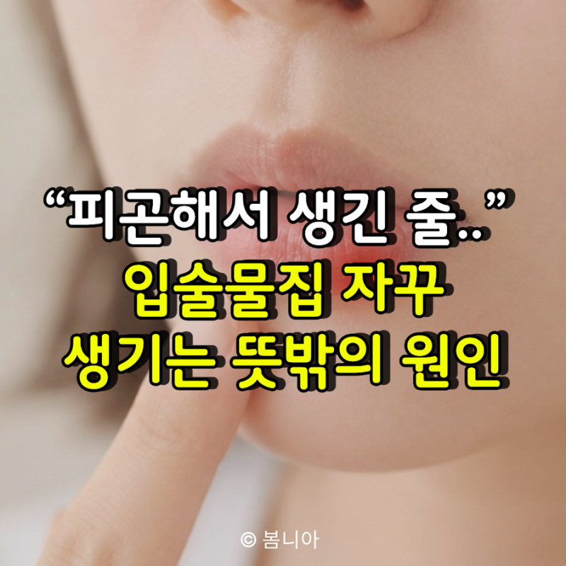 “피곤해서 생긴 줄 알았는데..” 입술포진, 물집을 반복시키는 뜻밖의 원인 5가지