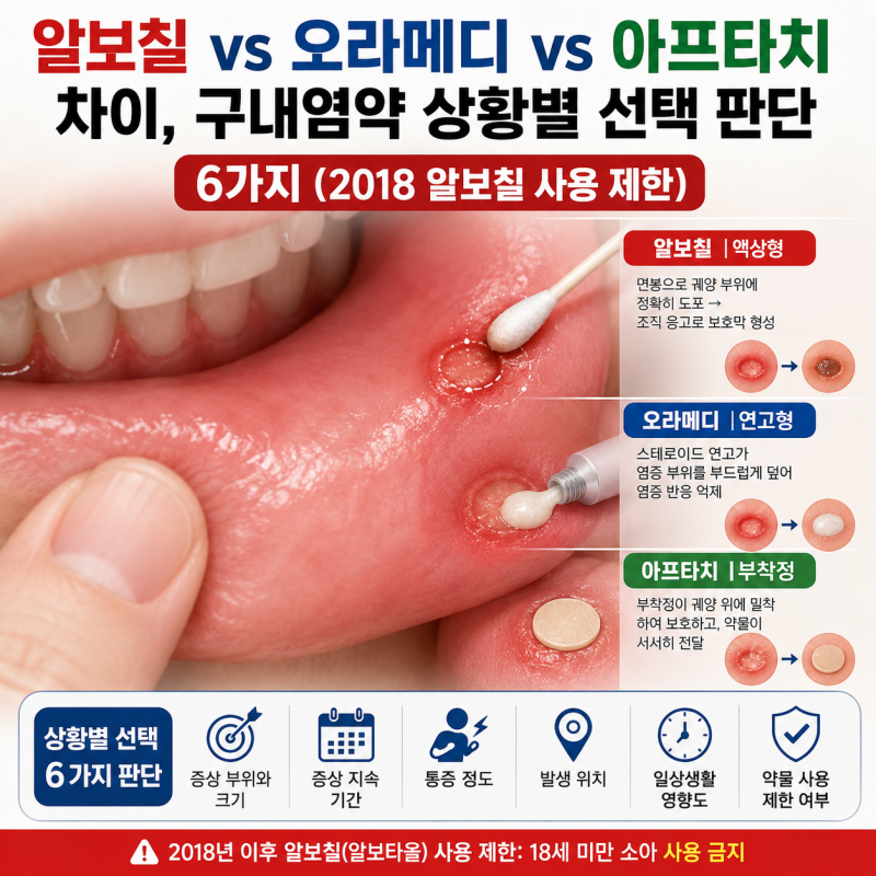 알보칠 vs 오라메디 vs 아프타치 차이, 구내염약 상황별 선택 판단 6가지 (2018 알보칠 사용 제....