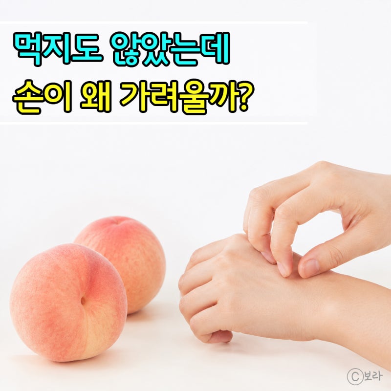복숭아효능 좋다는데 껍질만 만져도 손이 가려운 이유