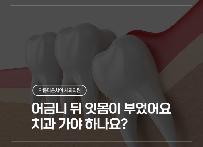 어금니 뒤 잇몸 부음의 원인, 치과 가야 하는 경우는?
