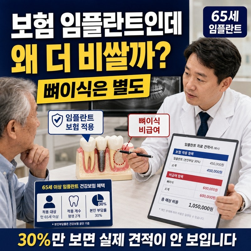 임플란트 뼈이식 건강보험 될까｜65세 이상도 따로 내는 비용