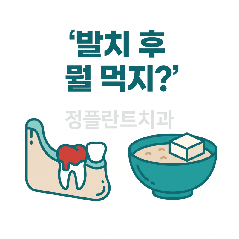 신창치과 발치 후 음식 | 언제부터 뭘 먹고 뭘 피할지, 피딱지 지키는 식사법