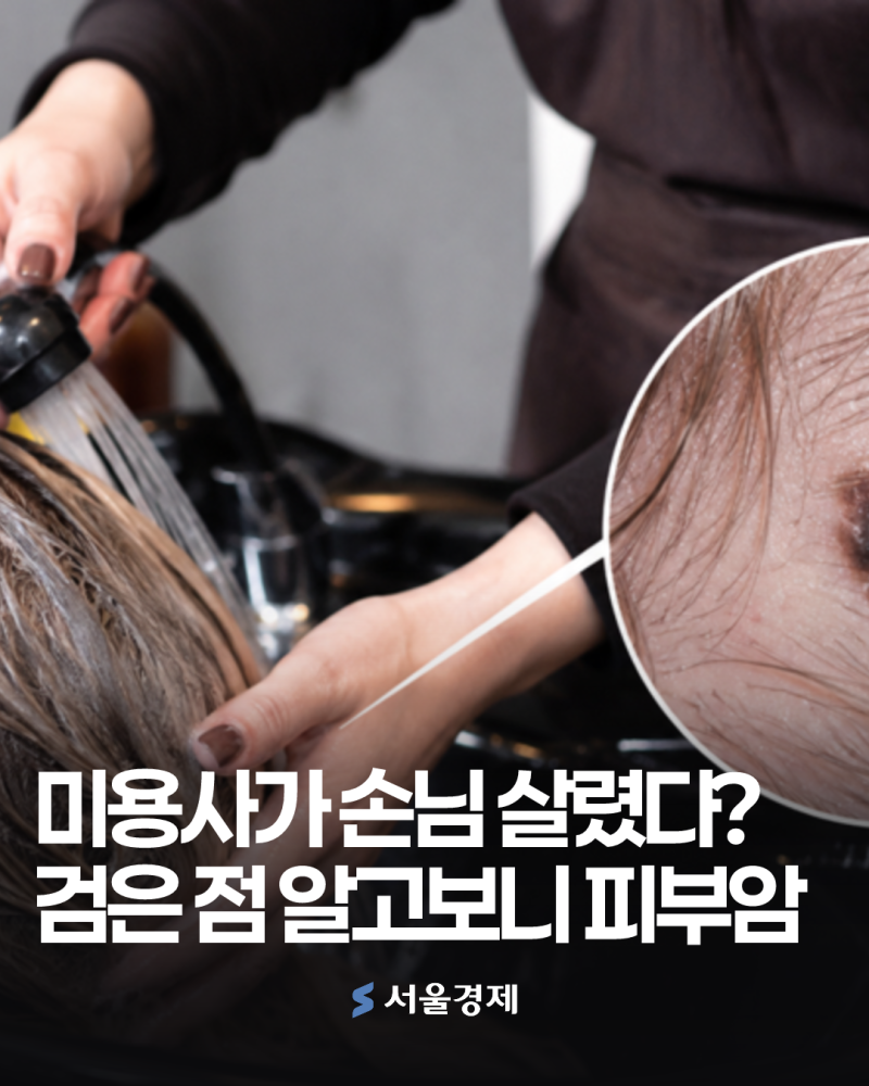 "평범한 점인 줄만 알았는데"…미용실에서 발견한 두피 위 신호, 알고 보니 피부암 [헬시타임....