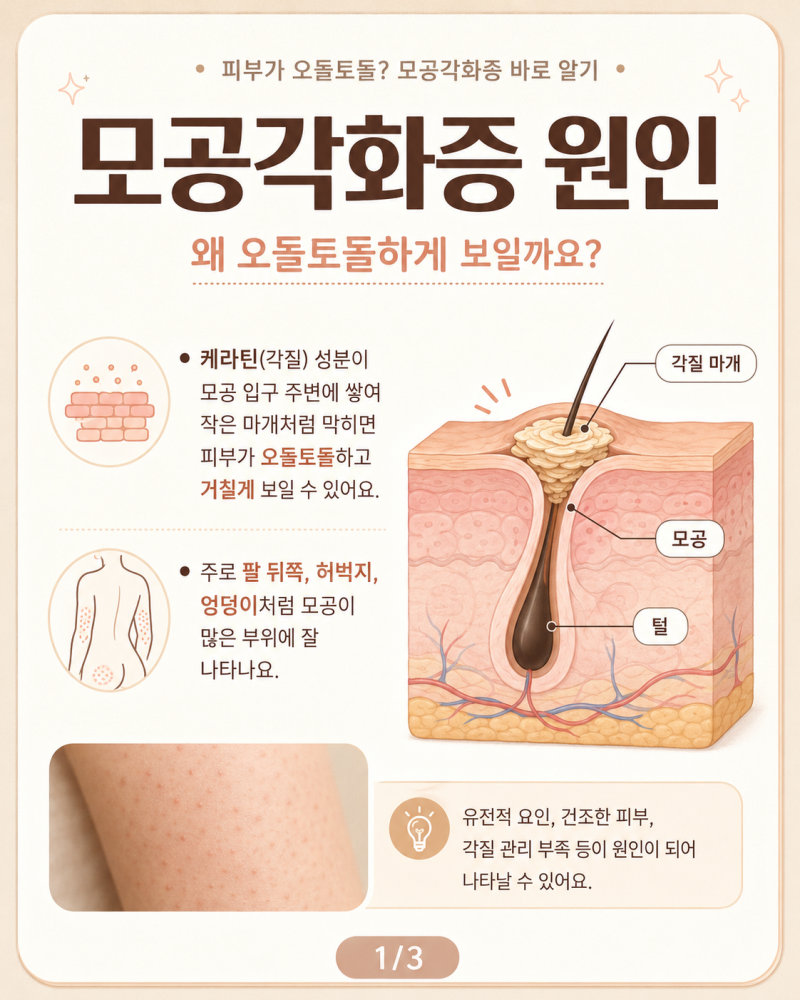 모공각화증 원인 왜 생길까? 팔 허벅지 닭살피부 관리법까지 정리