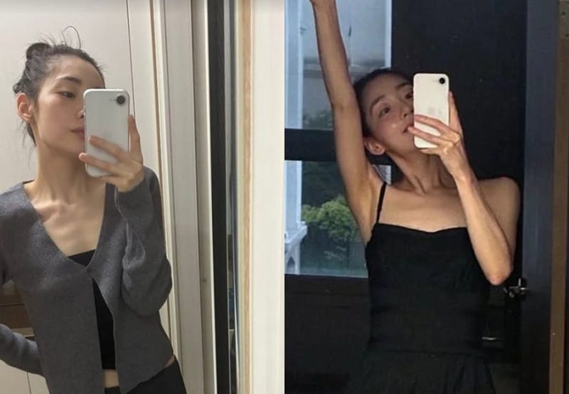 김민하, 가슴뼈 드러난 민소매 셀카의 전말…단순 다이어트가 아니었다