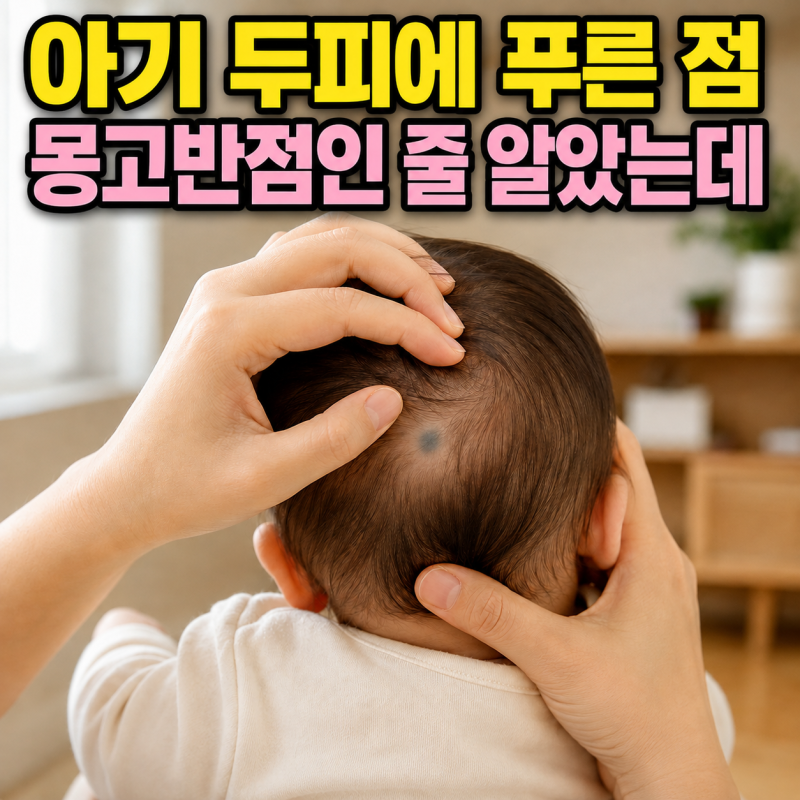 청색모반 아기 두피 푸른 점, 몽고반점과 어떻게 다를까