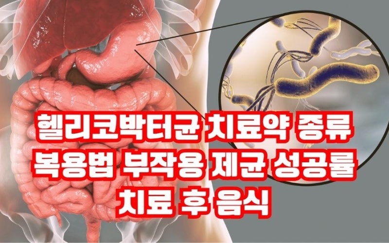헬리코박터균 치료약 종류 복용법 부작용 제균 성공률 치료 후 음식