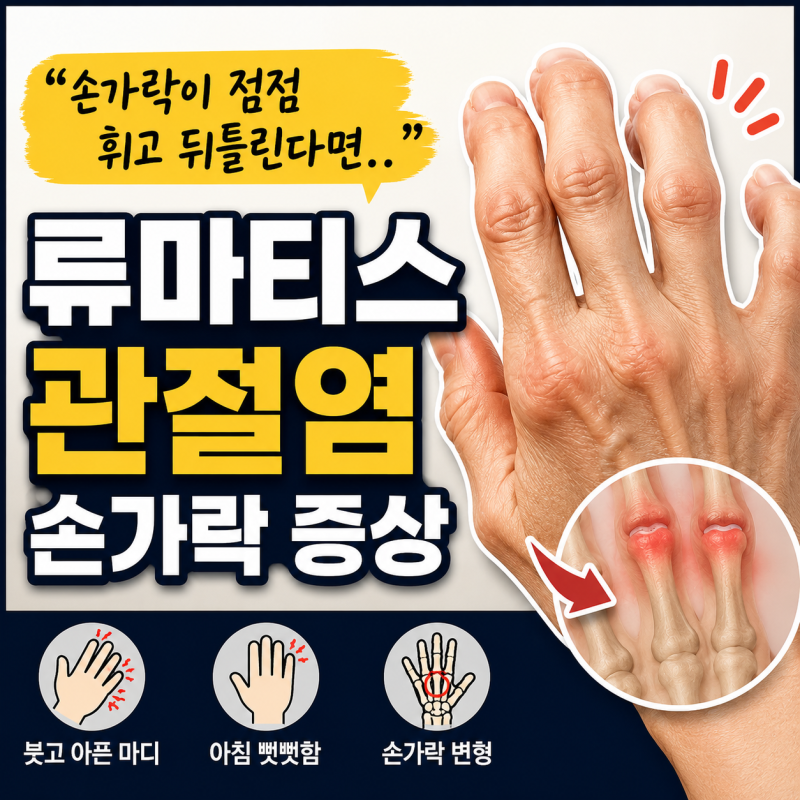 “손가락이 점점 휘고 뒤틀린다면..” 류마티스 관절염 손가락 증상