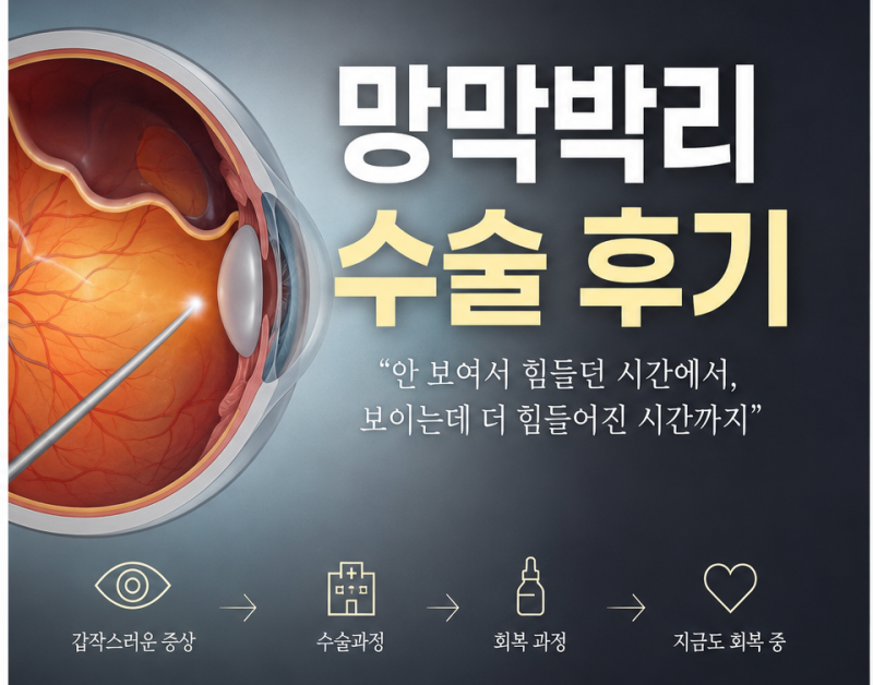 안 보여서 힘들던 시간에서, 보이는데 또 힘들어진 시간까지(망막박리수술 후기)
